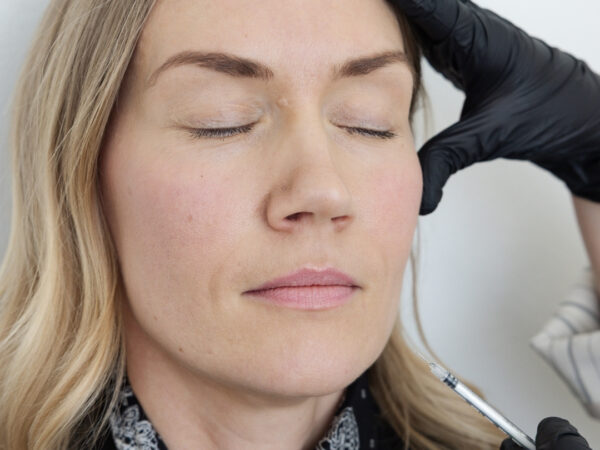 Kasvojen lihakset: anatomia ja sen merkitys botox-hoidoissa