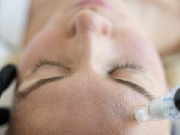Enlarged Pores – From Problem to Solution