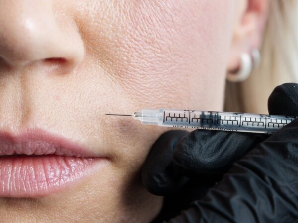 Marionette Lines – Causes and Treatment Options