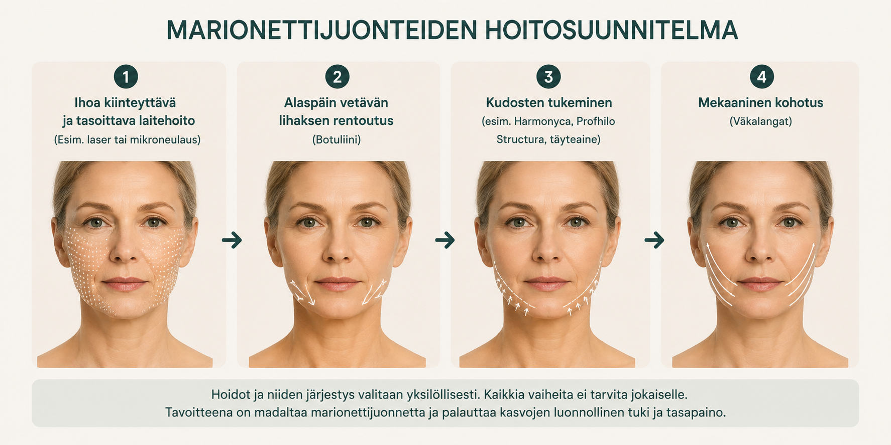 marionettijuonteiden hoito